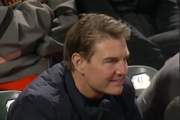 Tom Cruise aparece com rosto inchado em jogo de baseball.