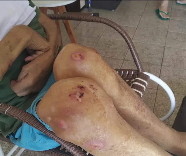 Também estão no processo imagens das feridas dos idosos
