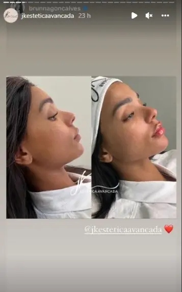 brunna gonçalves