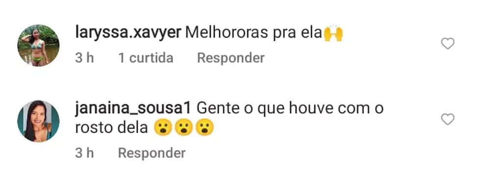 Print de comentários de usuários sobre rosto inchado de Joelma