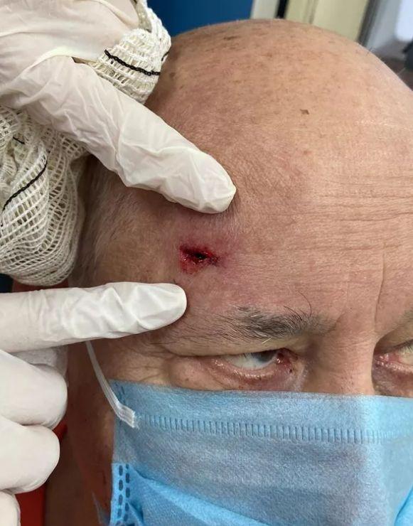 ferimento na cabeça de idoso que se envolveu em acidente com elba ramalho