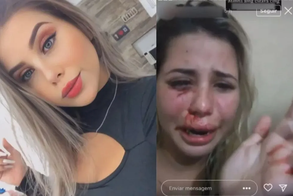 Amanda publicou imagens das agressões