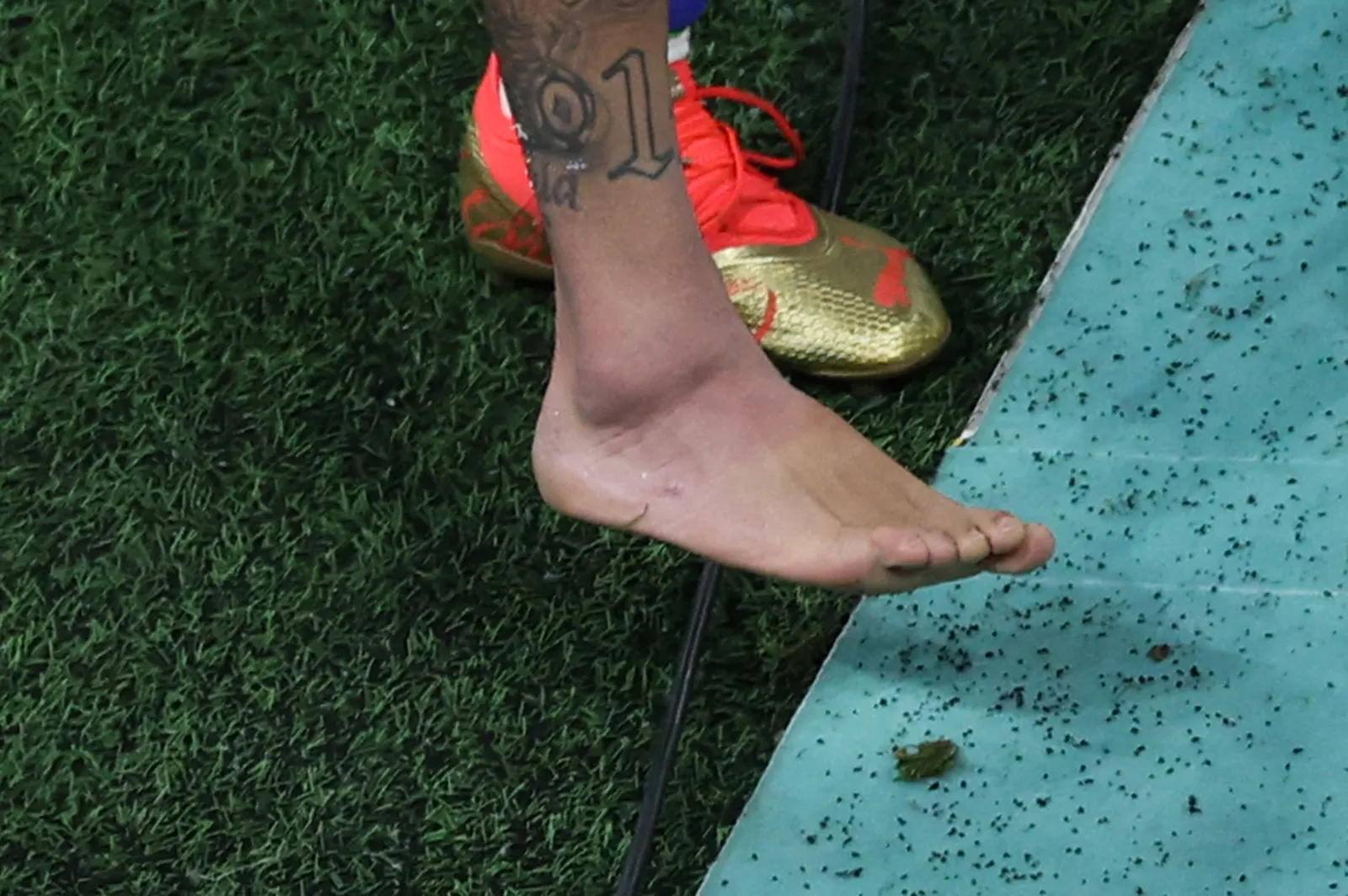 O tornozelo de Neymar ficou muito inchado após a lesão na estreia da Copa do Mundo