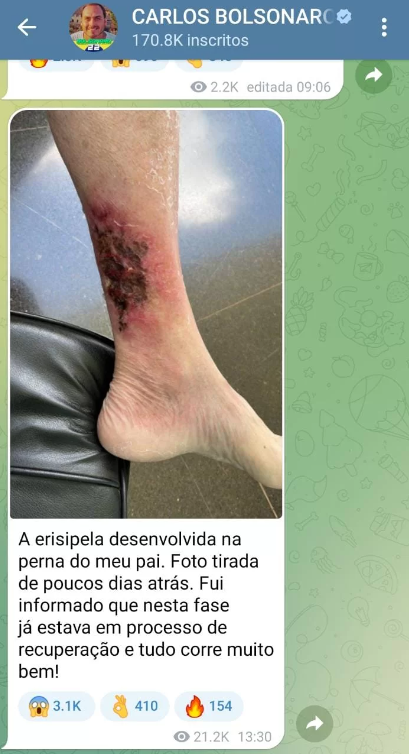 Captura de tela de publicação de Carlos Bolsonaro no Telegram com perna de Bolsonaro ferida por erisipela