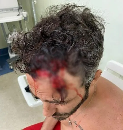 Imagem do ator sendo atendido na unidade hospitalar após agressão