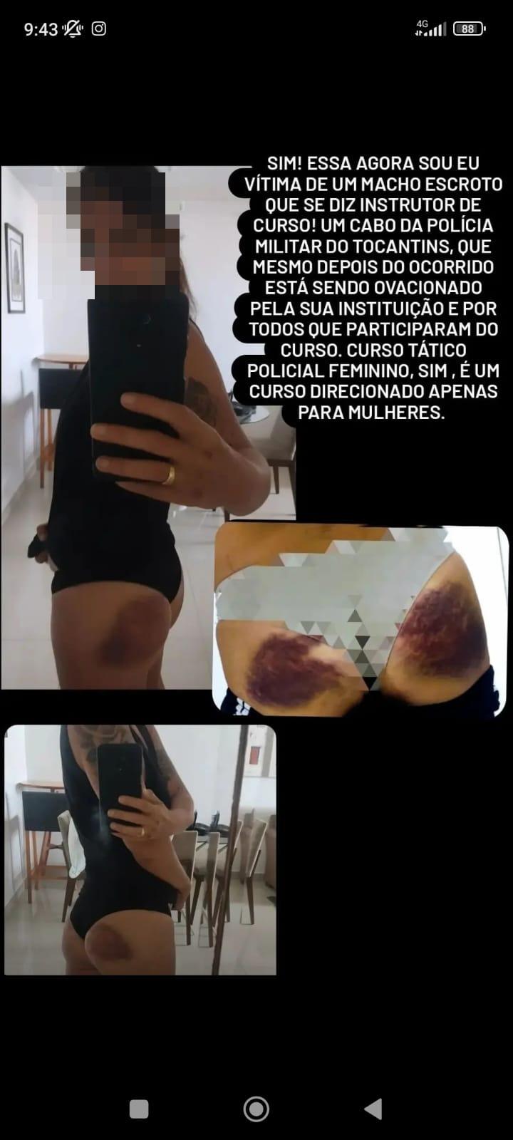 relato e foto de agressão sofrida por policial maranhense em curso no Ceará