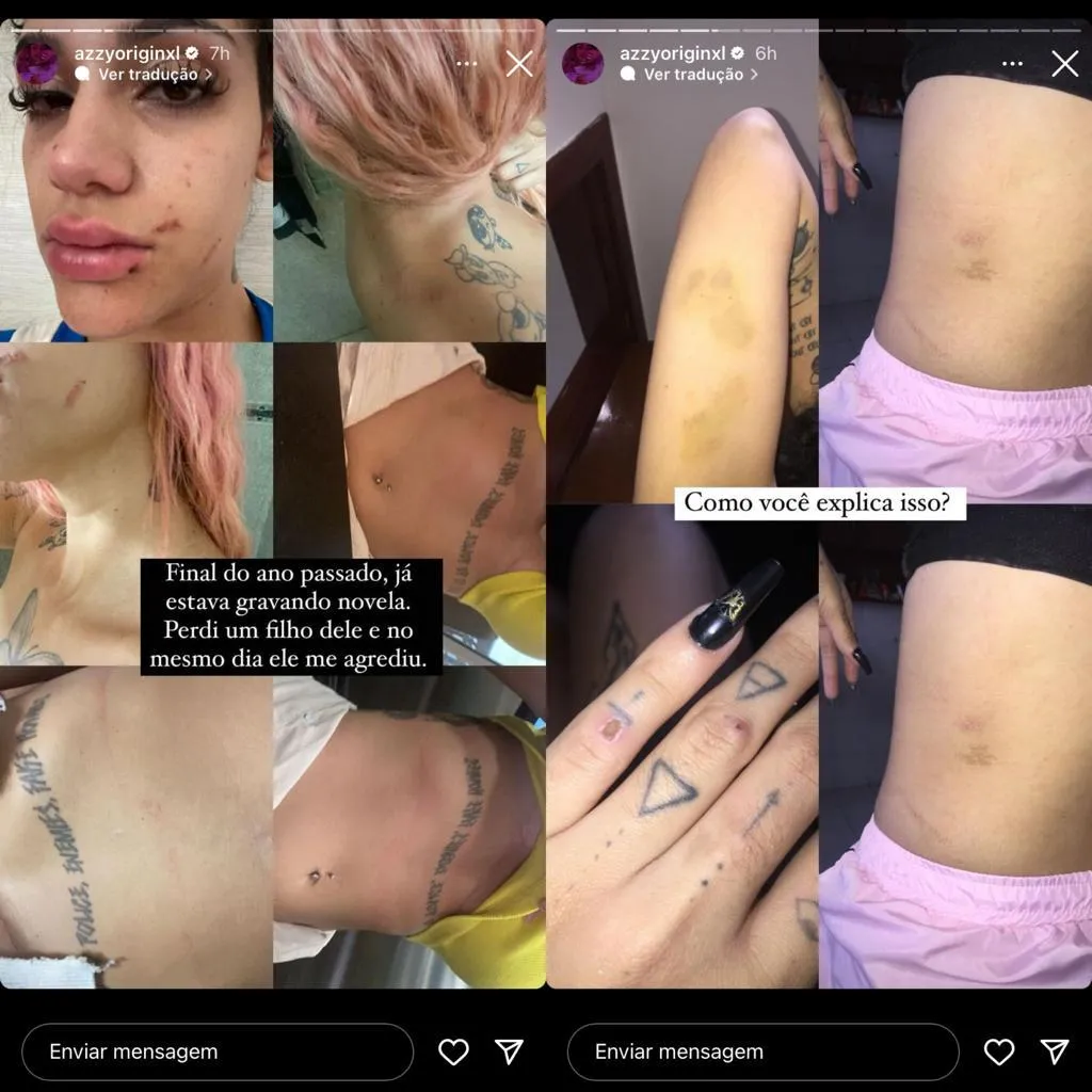 Azzy publicou fotos das agressões nas redes sociais