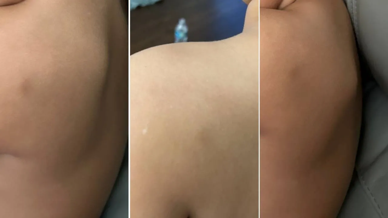 Inicialmente, mãe entendeu que filho tinha sido agredido por outra criança