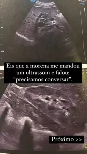 Felipe Neto compartilha ultrassom da namorada