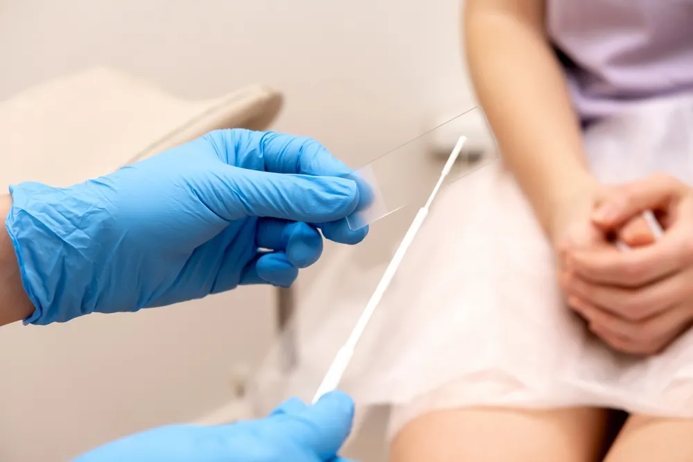 Pessoas com sintomas de candidíase devem buscar um médico