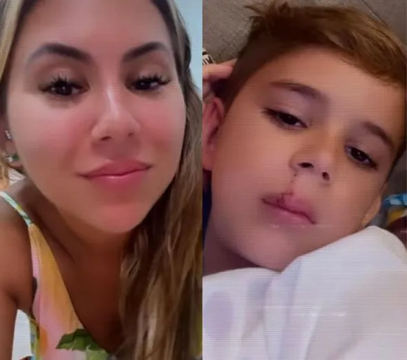 Natalia compartilhou imagem da ferida do filho