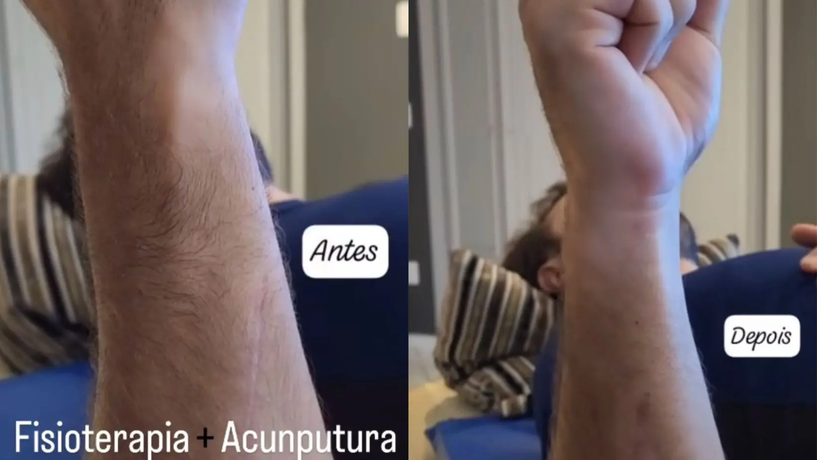 Kayky Brito mostra antes e depois após grave acidente