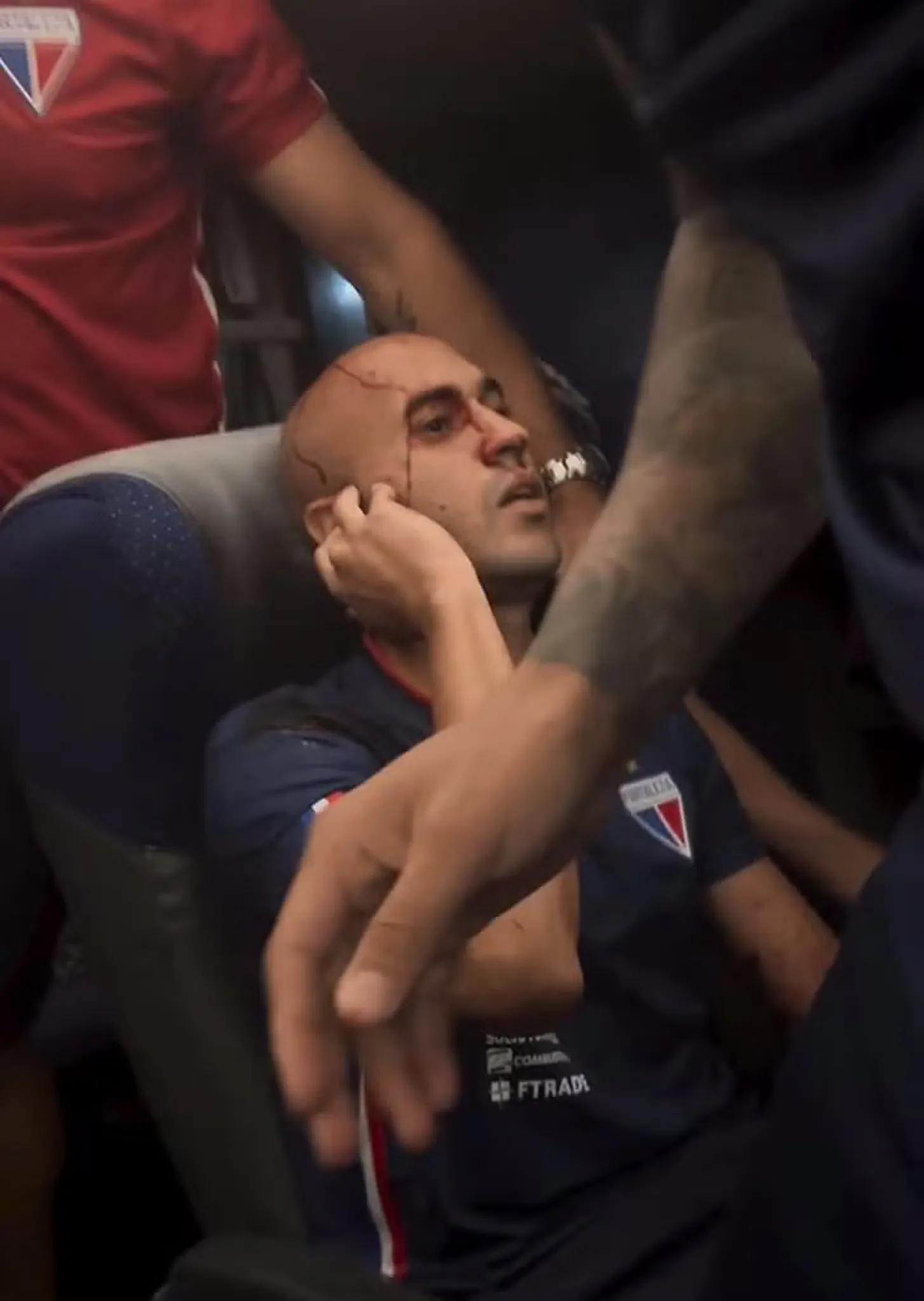 Lateral-direito Dudu ficou ferido