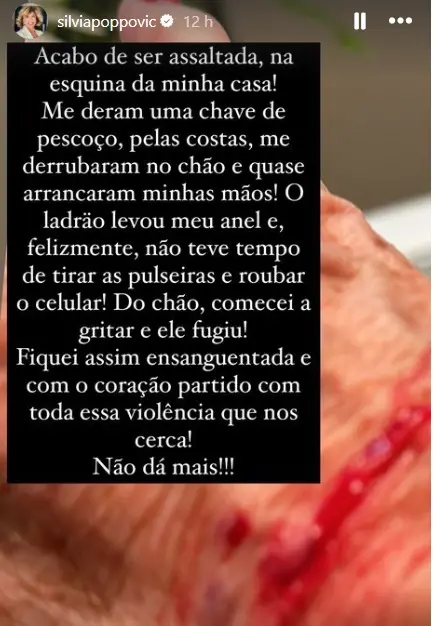 reprodução de storie de instagram