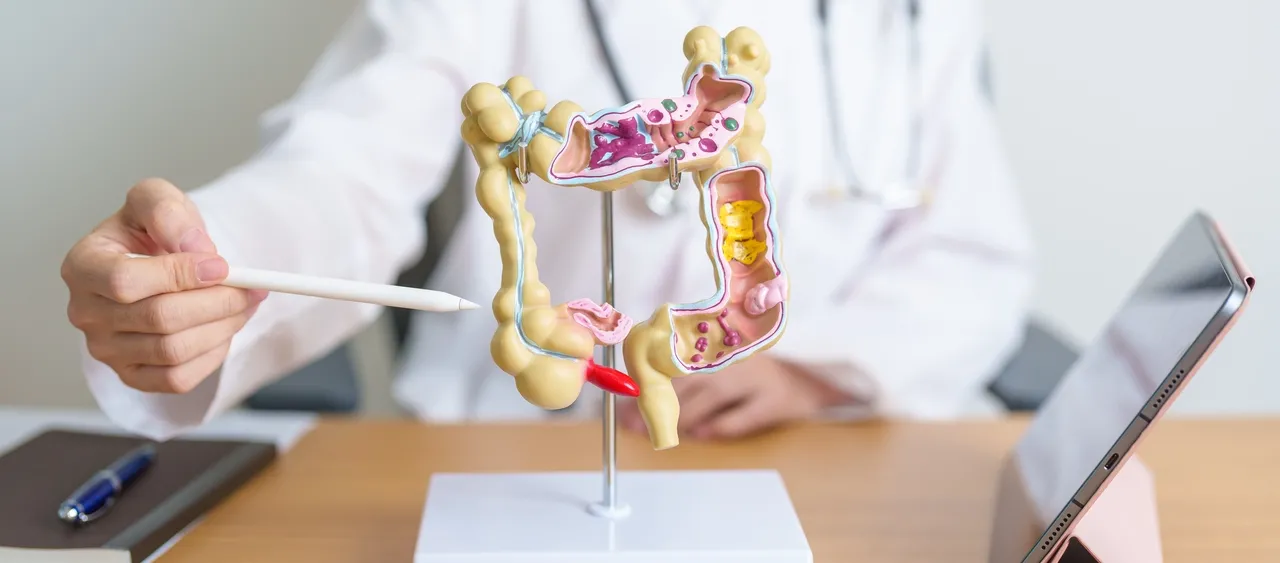 A apendicite é uma inflamação do apêndice cecal, que é uma pequena parte do intestino localizado no cólon direito
