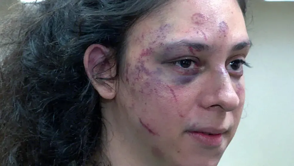 O ator e influenciador Victor Meyniel foi espancado em setembro de 2023 por um estudante de medicina