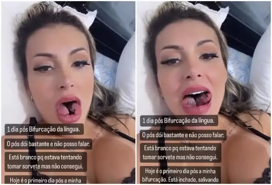 Montagem de Andressa Urach