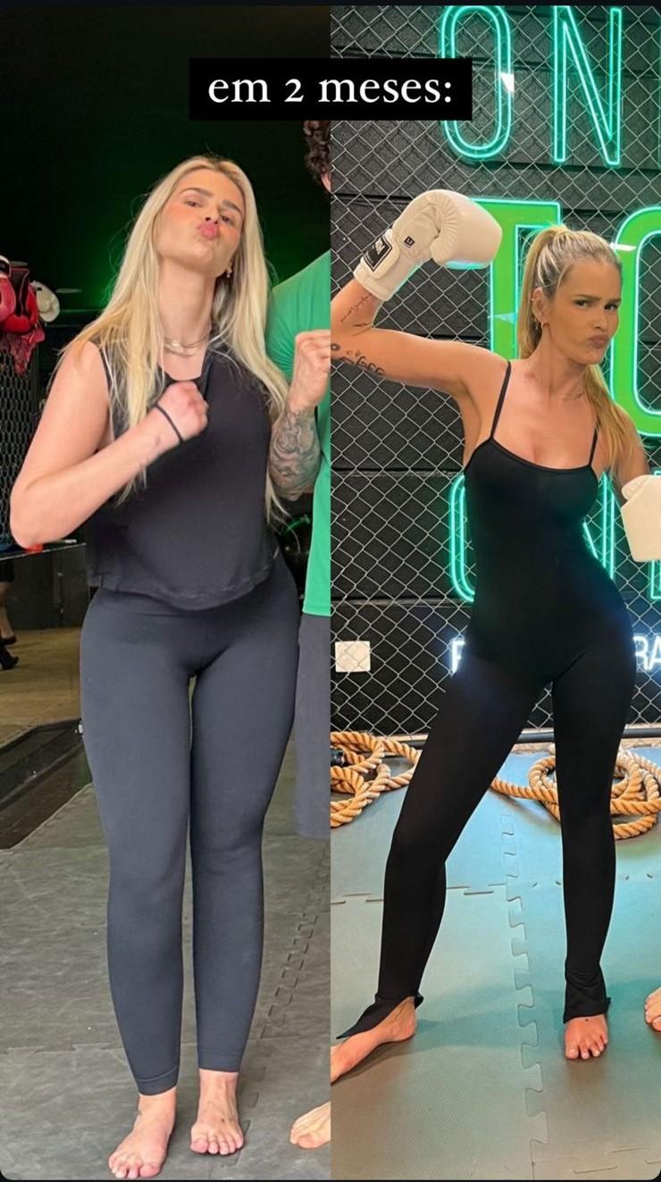 Yasmin Brunet começa a tratar lipedema e volta à 'era fitness'