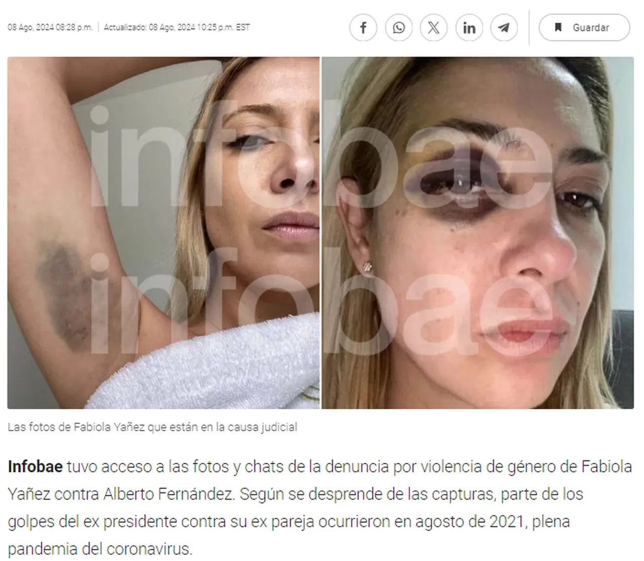 Ex-primeira dama mandou imagens de hematomas a um jornal argentino