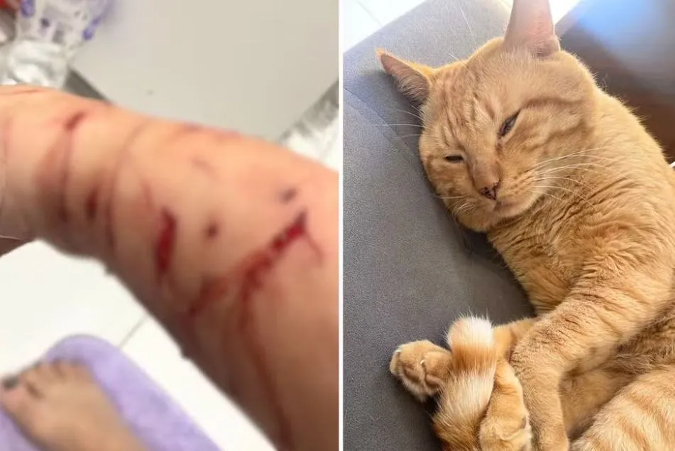Ataque mais recente do gato resultou em diversos arranhões e cortes em tutora, que buscou ajuda profissional para lidar com o caso