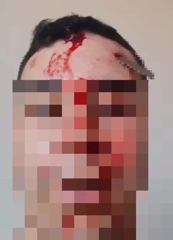 Vítima lutou contra o assaltante e foi esfaqueada na cabeça