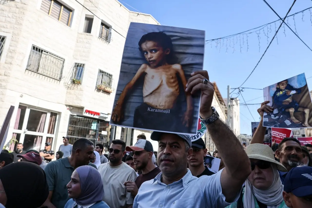 Homem em protesto segura foto de criança palestina desnutrida