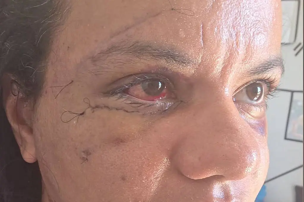 Registro de parte do rosto de Juliana