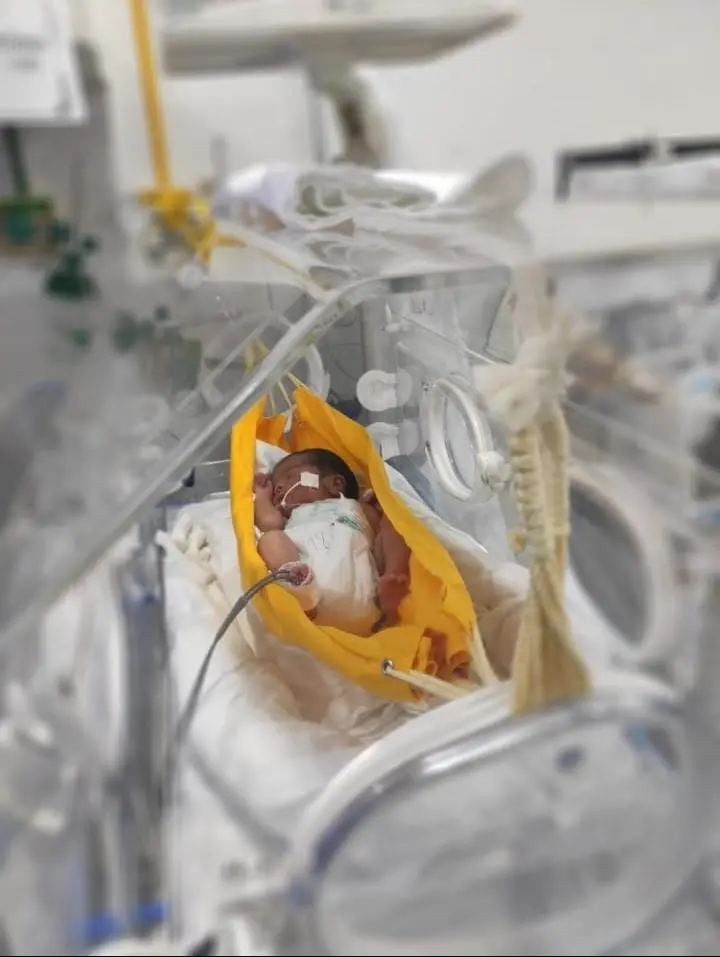 bebê em rede no hospital