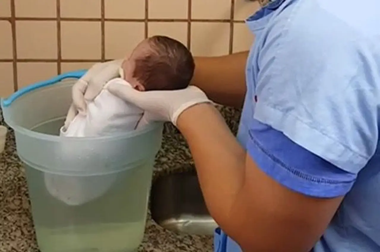 Profissional de saúde, usando luvas, segura um bebê recém-nascido, que está em um balde transparente com água, usando a técnica de hidroterapia. O bebê está de costas e apenas a parte superior do seu corpo está visível acima da água.