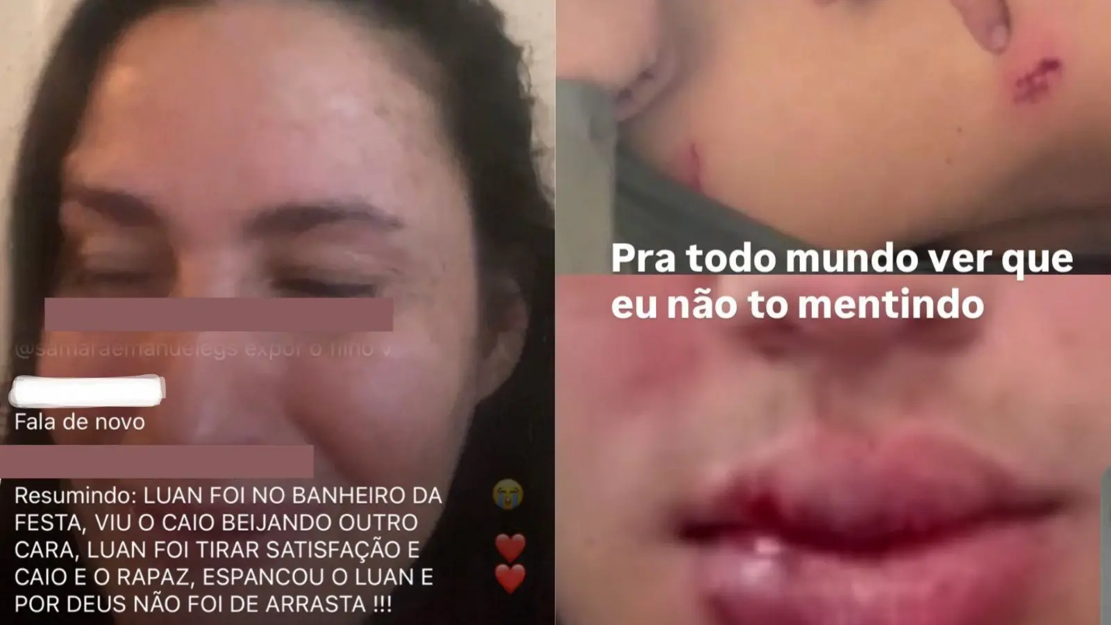 Mãe de Luan, Helida, fazendo uma live no Instagram. Ao lado da colagem dela, fotos com o rosto e parte do corpo do filho, Luan, machucados devido as agressões.
