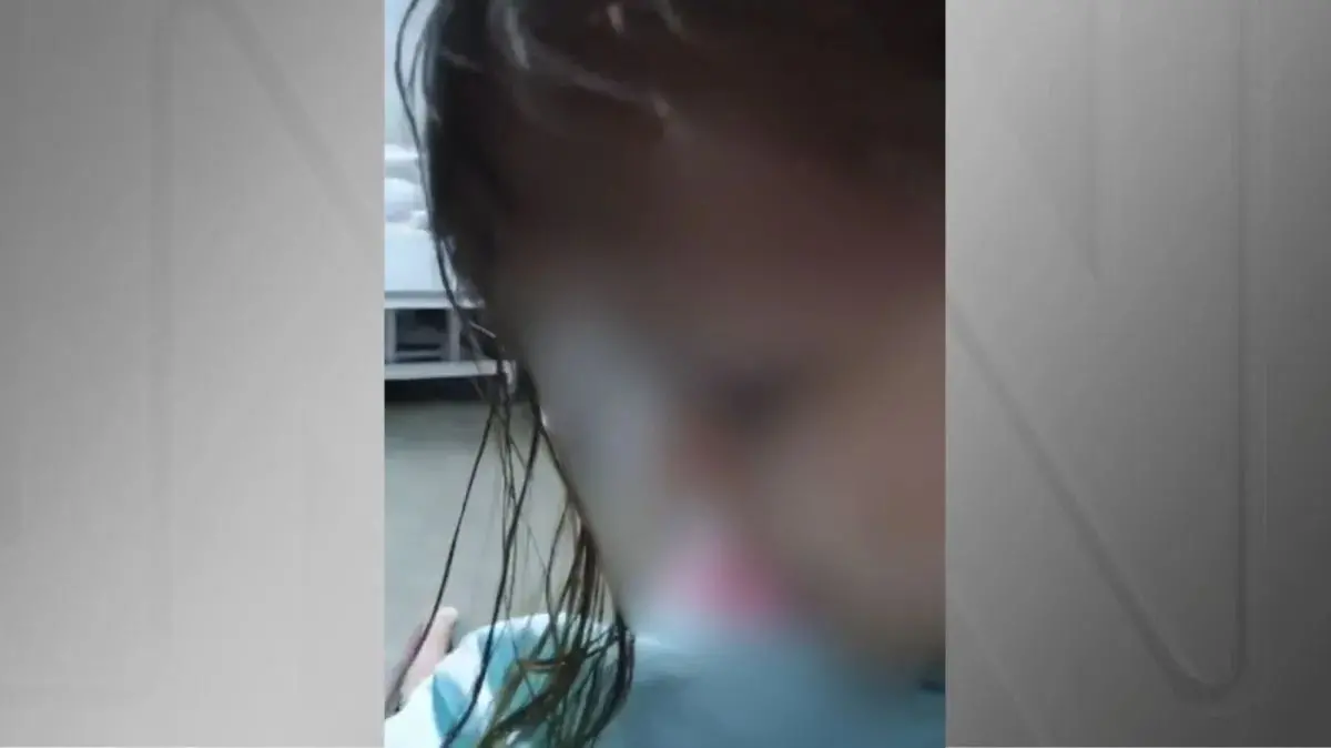Menina agredida pelo padrasto aparece em vídeo, com  marcas no rosto, falando do agressor