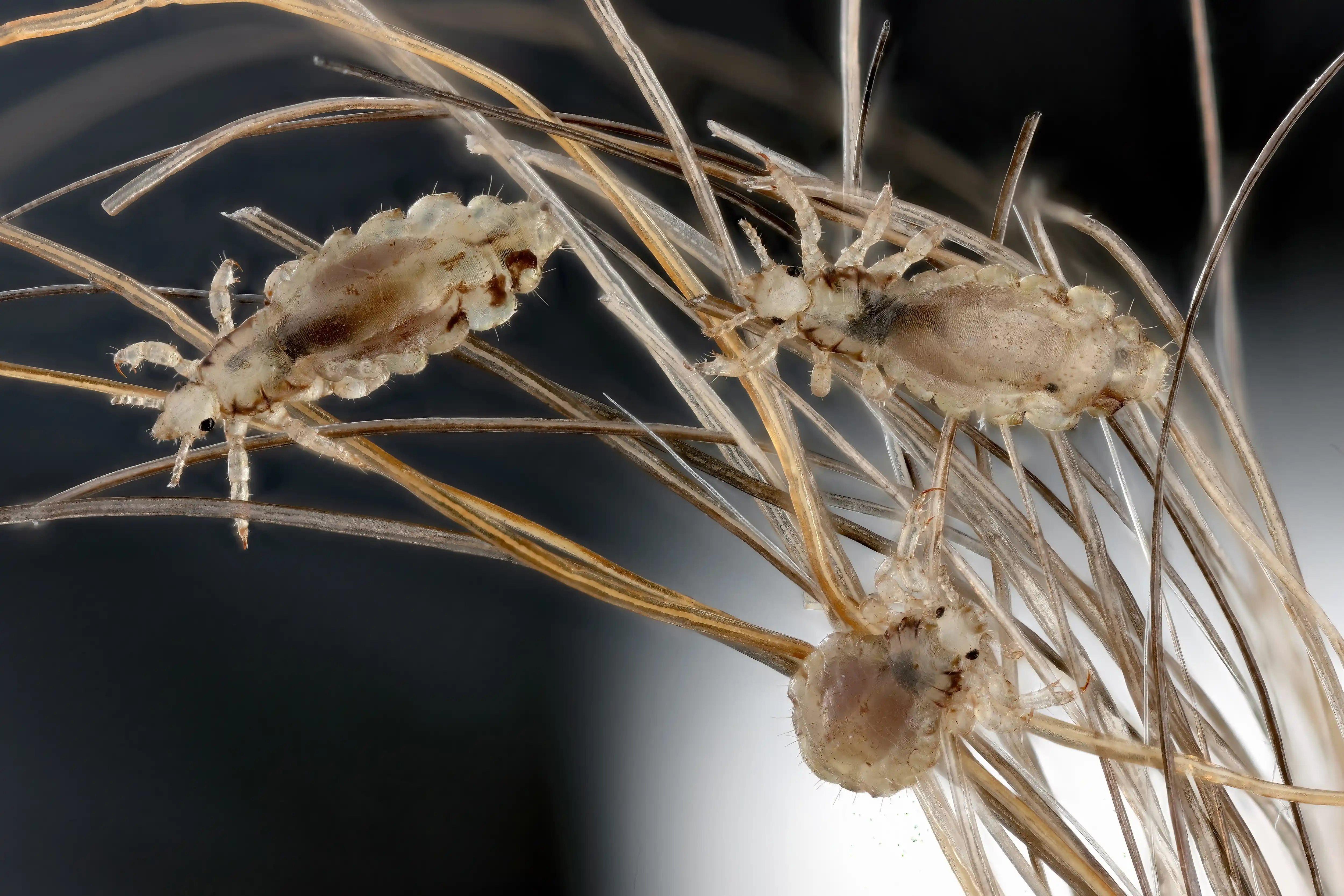 Piolho da cabeça, Pediculus humanus capitis, em um cabelo humano. Imagem usada em matéria sobre coceira na cabeça o que pode ser
