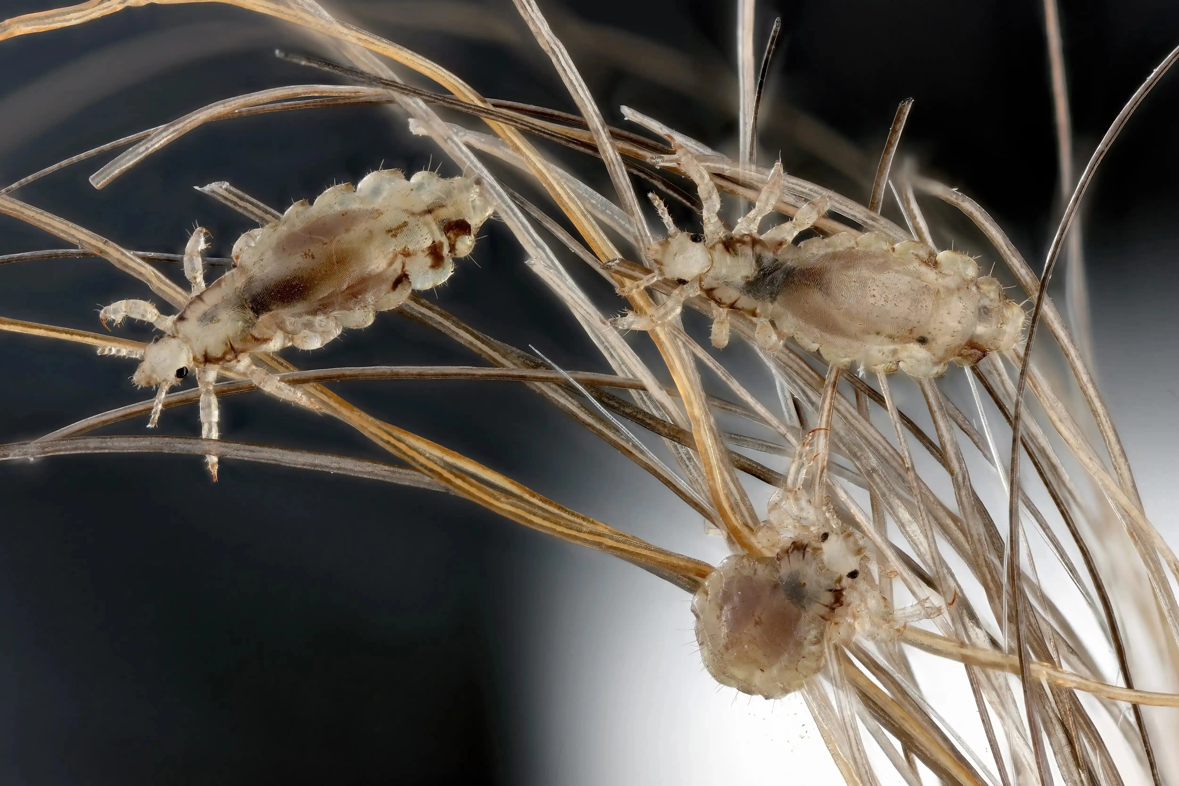 Piolho da cabeça, Pediculus humanus capitis, em um cabelo humano. Imagem usada em matéria sobre coceira na cabeça o que pode ser