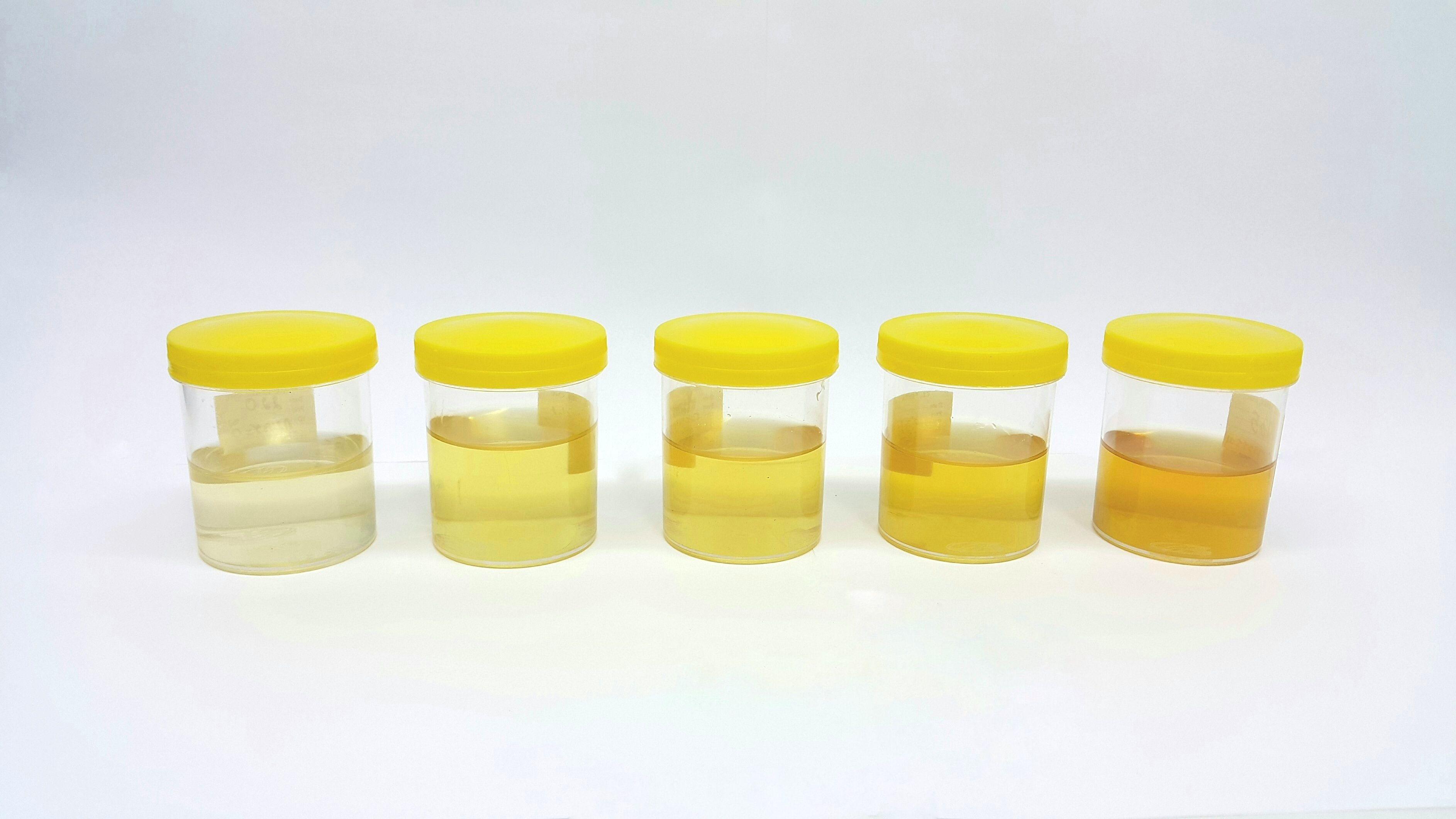 Imagem mostra cinco frascos de coleta com diferentes tons de urina, variando do amarelo muito claro ao âmbar escuro, ilustrando a escala de coloração usada para avaliar níveis de hidratação e desidratação.