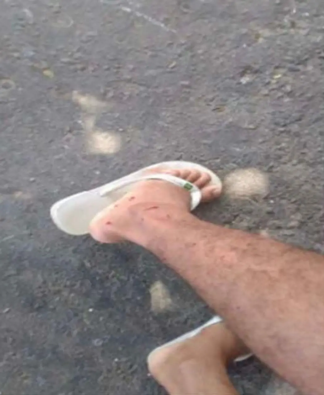 Pera machucada com estilhaços de tiro