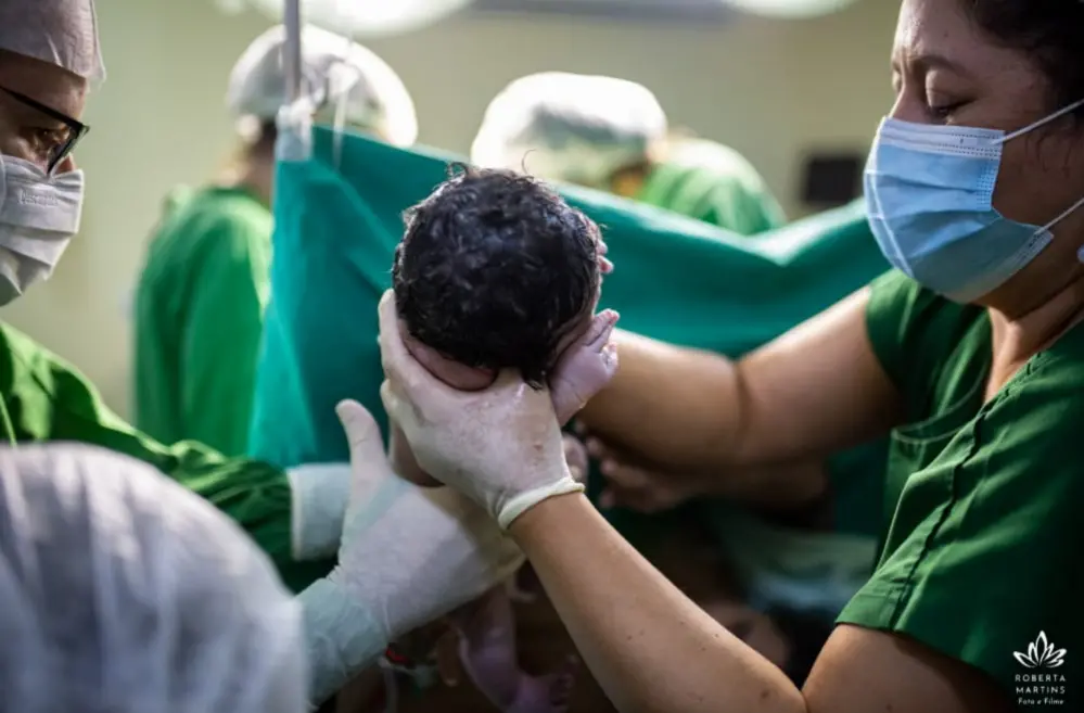 Na imagem, fotografia em plano fechado capturando o momento de um nascimento em ambiente hospitalar. No centro, as mãos enluvadas de um profissional de saúde e as mãos sem luvas de outra pessoa (indicando o apoio da doula ou acompanhante) amparam a cabeça de um recém-nascido, que tem cabelos escuros e úmidos. À direita, uma mulher de máscara cirúrgica azul e roupa verde observa o bebê com atenção. À esquerda, parte do rosto de outro profissional de saúde com óculos e máscara é visível. Ao fundo, a cena é composta por tecidos cirúrgicos verdes e outros profissionais desfocados sob a luz forte do centro cirúrgico. No canto inferior direito, há uma logomarca branca com o nome 