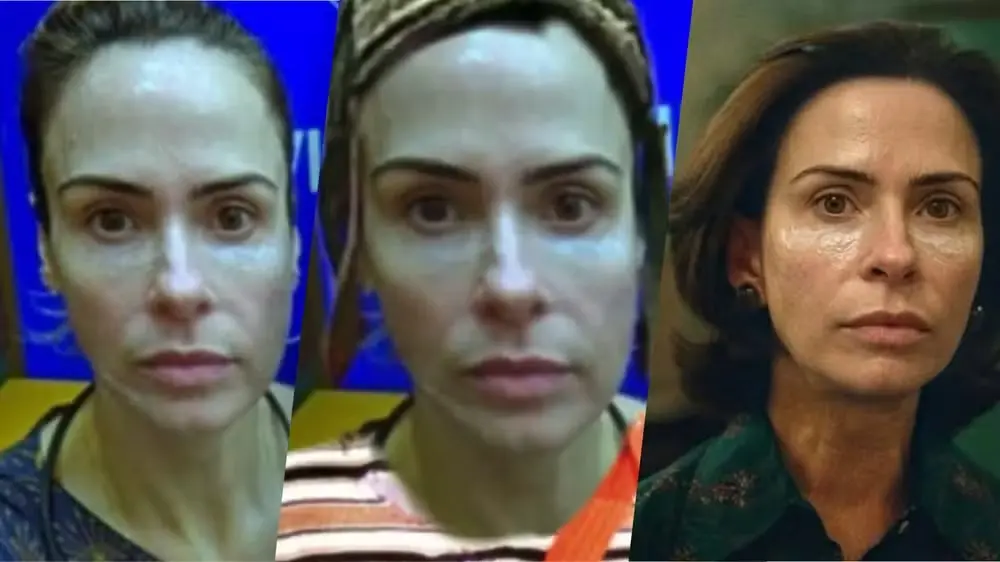 Transformações de pele de uma mulher, mostrando antes e depois de tratamentos de estética, destacando melhorias visíveis na aparência facial.