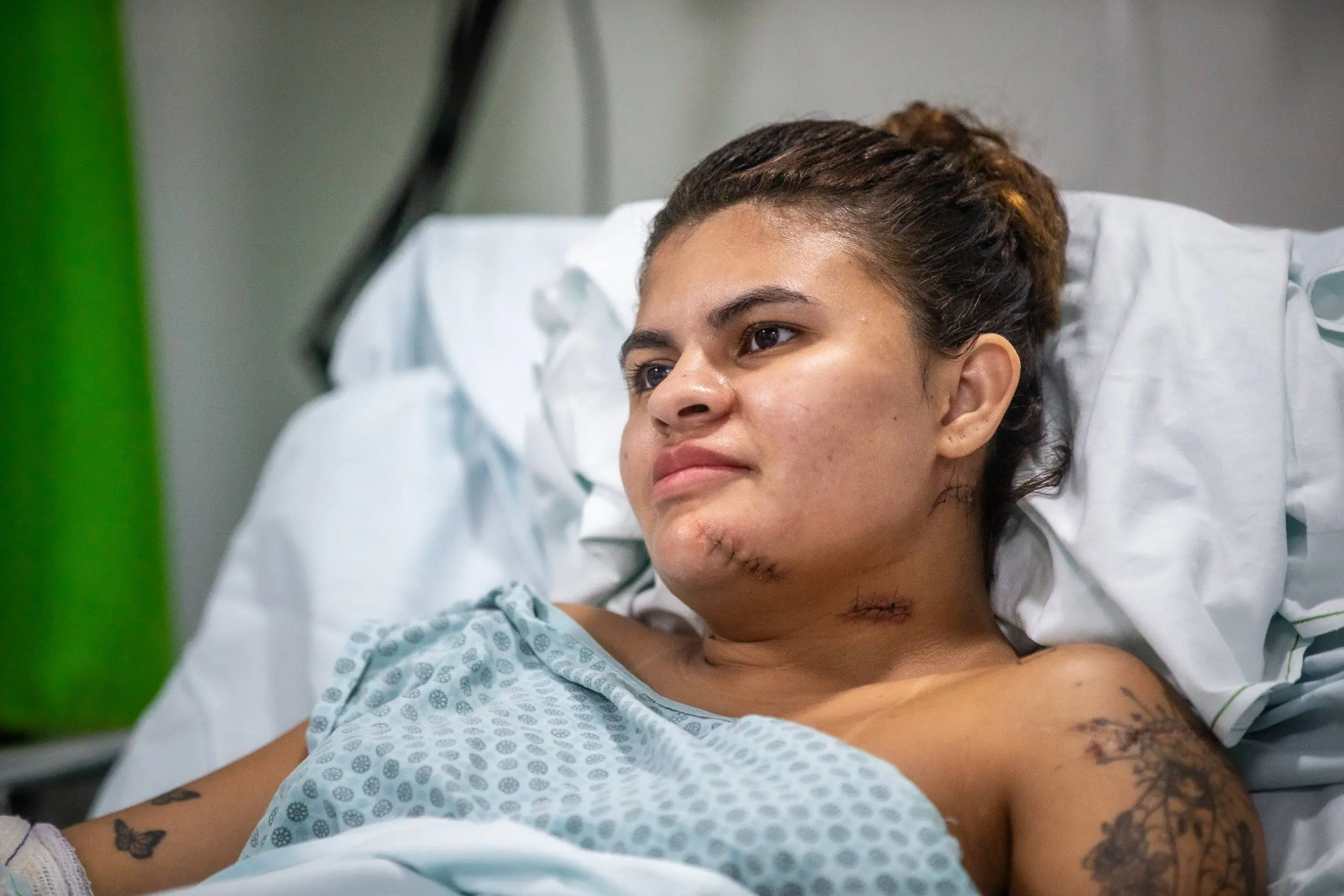 Imagem da notícia Ana Clara, jovem que teve mãos reimplantadas após ataque com foice, recebe alta do hospital 