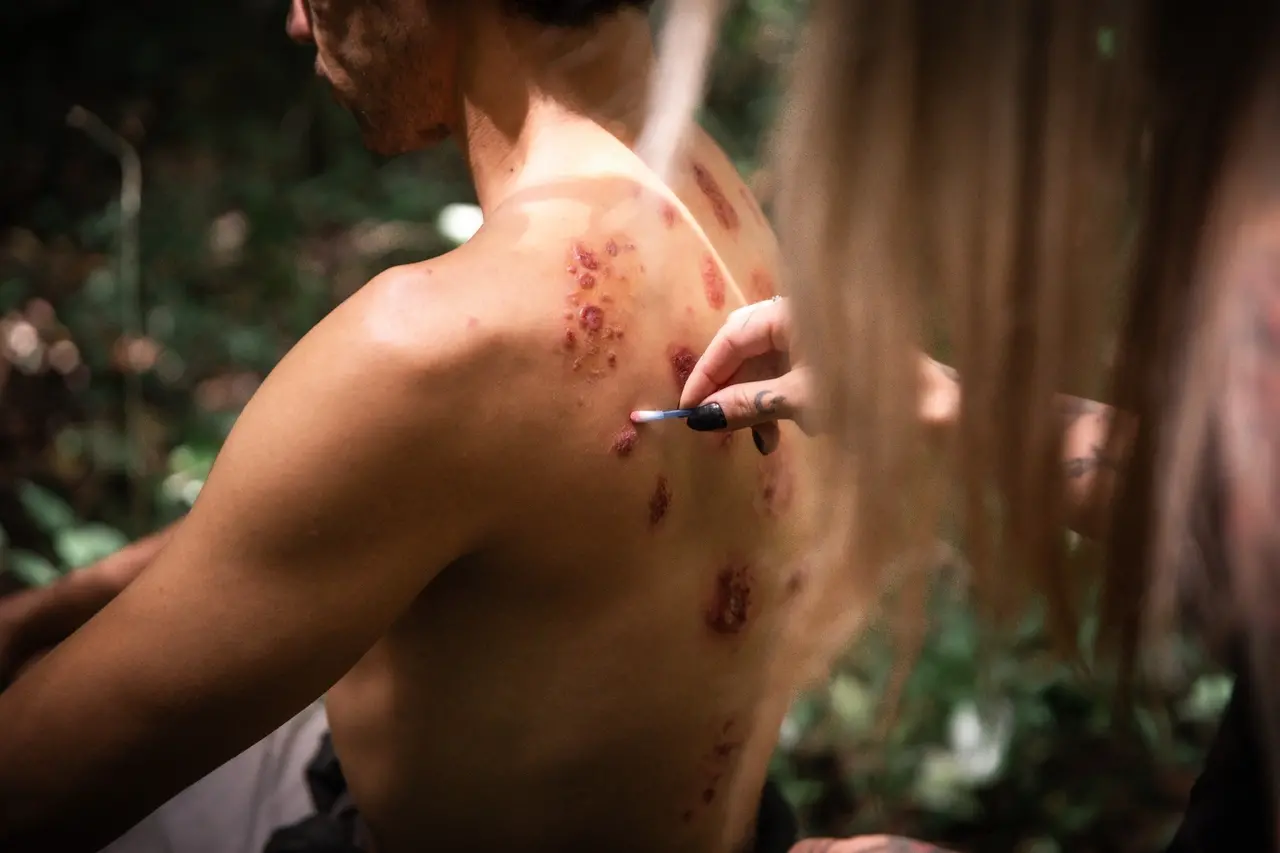 Uma profissional de maquiagem aplica efeitos especiais com um bastão nas costas do ator Lucas Galvino, destacando feridas avermelhadas e texturizadas espalhadas pelas suas costas. A cena de bastidores ocorre ao ar livre com fundo de vegetação desfocada, concentrando o foco nos detalhes da caracterização realista sob a luz natural.
