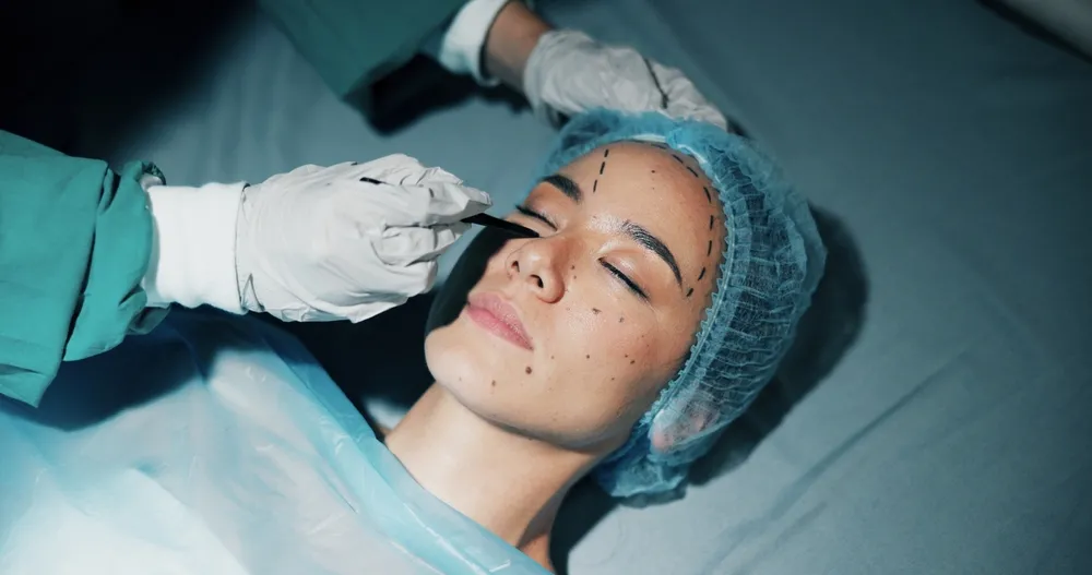 Cirurgia é indicada para quem tem flacidez moderada a avançada e marcas profundas no rosto.